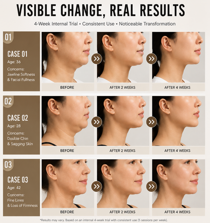 Vessa One Micro current Facial Device
